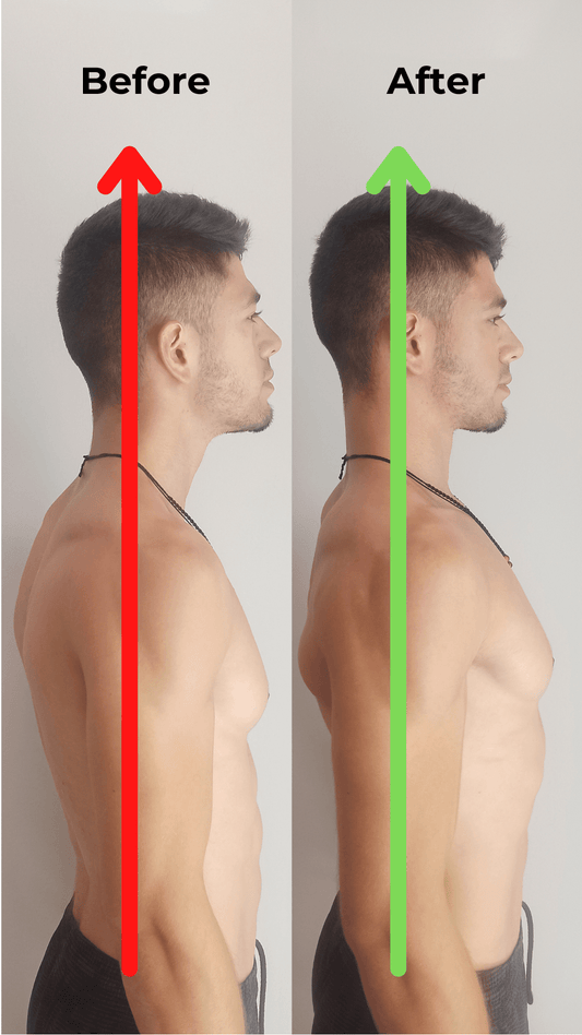 Head and Neck Posture + Mewing - Spartan Health™