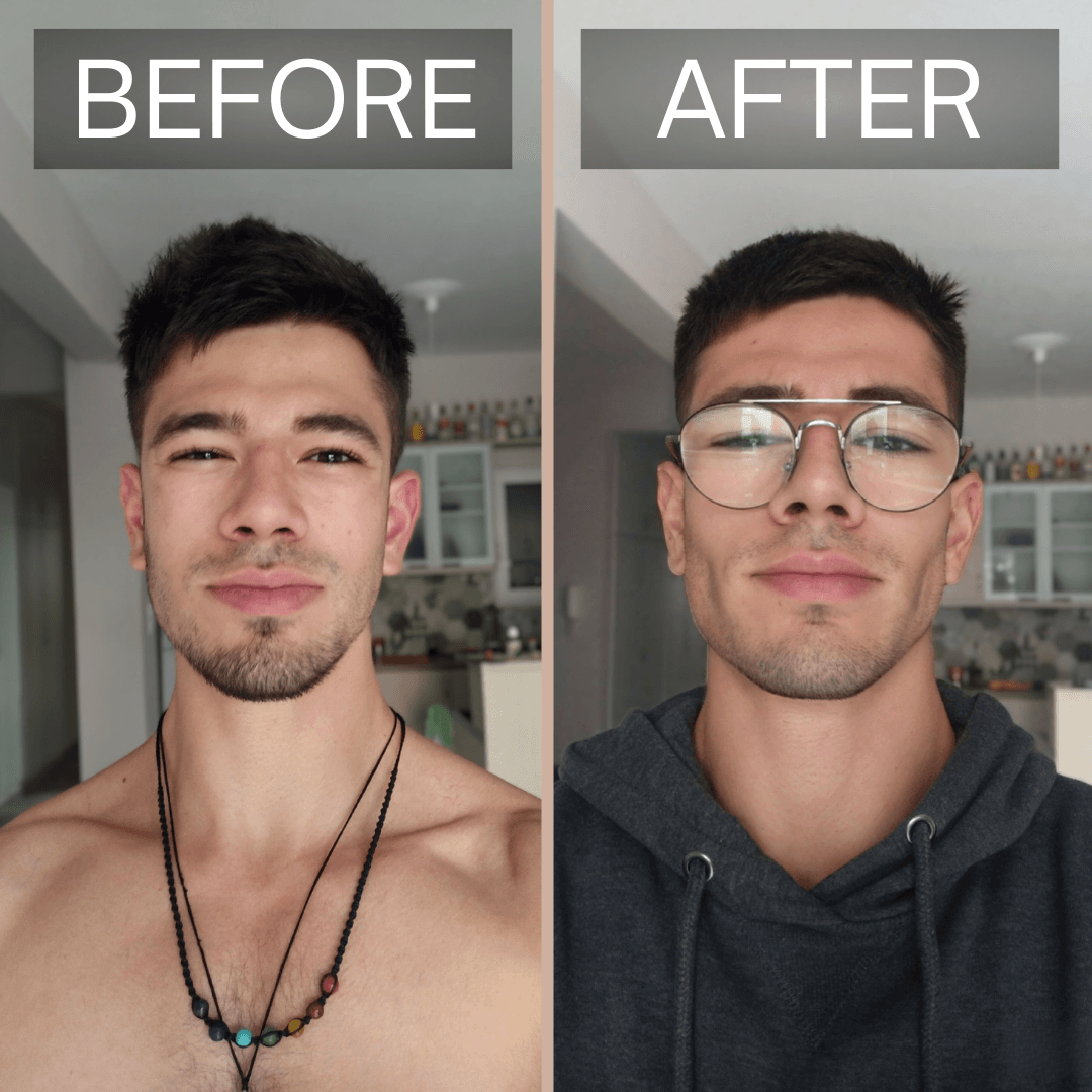 Spartan Gum before and after