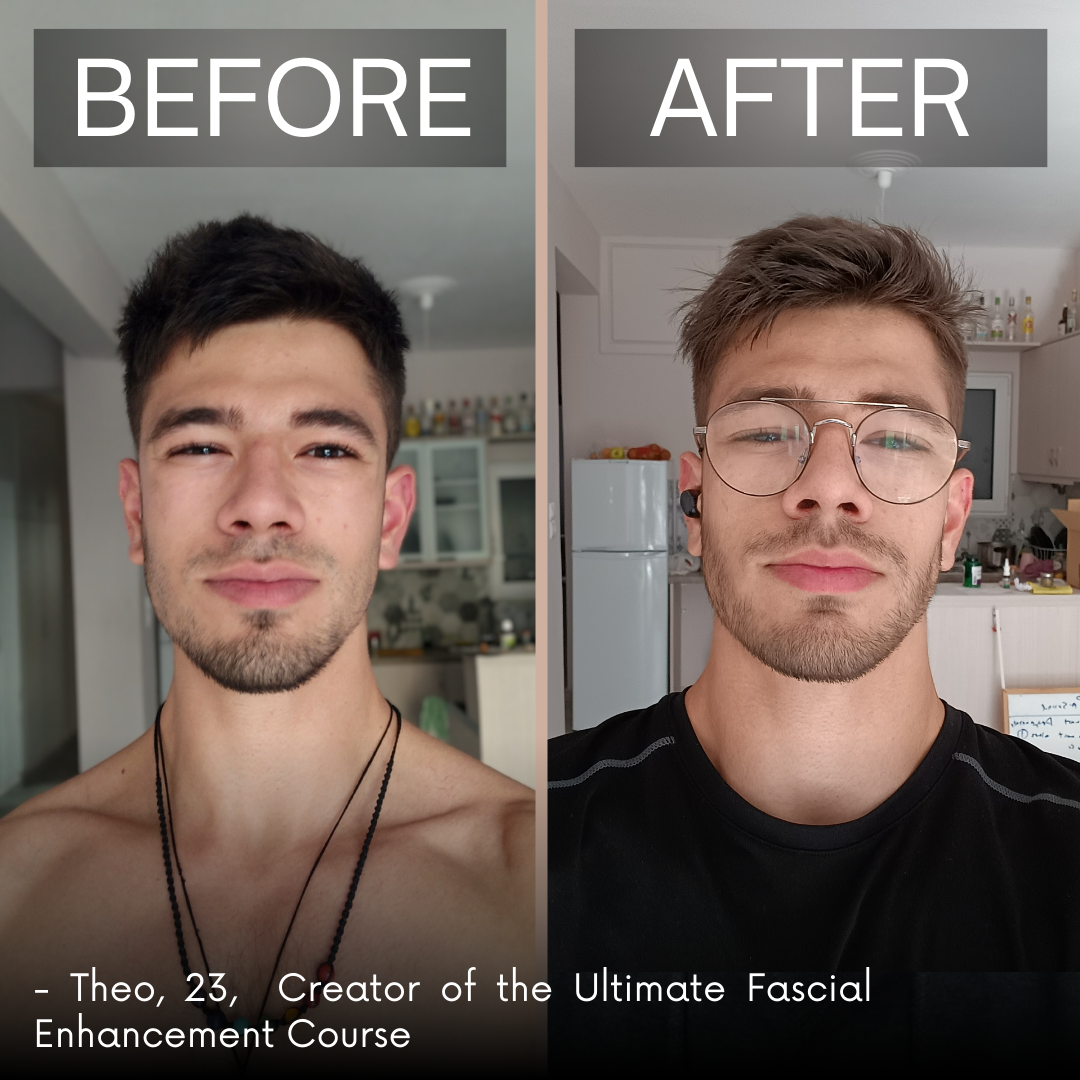 Ultimate Facial Enhancement Course