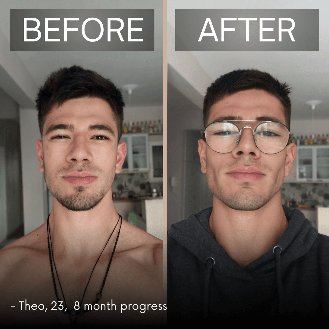 Do I Have Hunter Eyes A Comprehensive Guide To Understanding Your Eye do-i-have-hunter-eyes-a-comprehensive-guide-to-understanding-your-eye