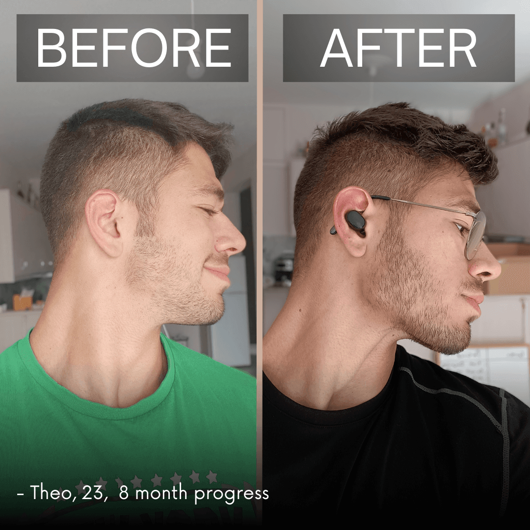 Tongue Chewing and Mewing: Unveiling The Secret to a Chiseled Jawline –  Spartan Health™